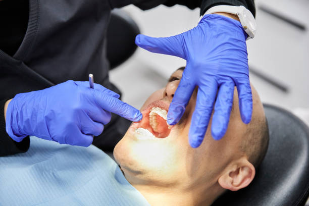 Best Emergency Wisdom Tooth Extraction in New London, MN